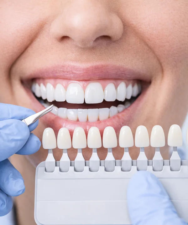 Estética dental
